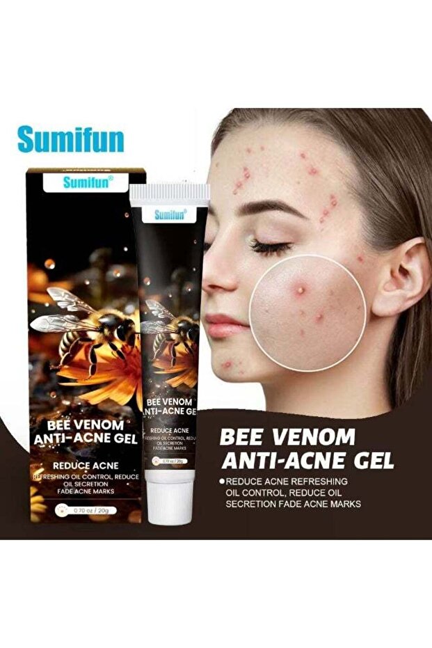 Bee-Venom Anti-Acne Gel, Acne Remover Gel 20g