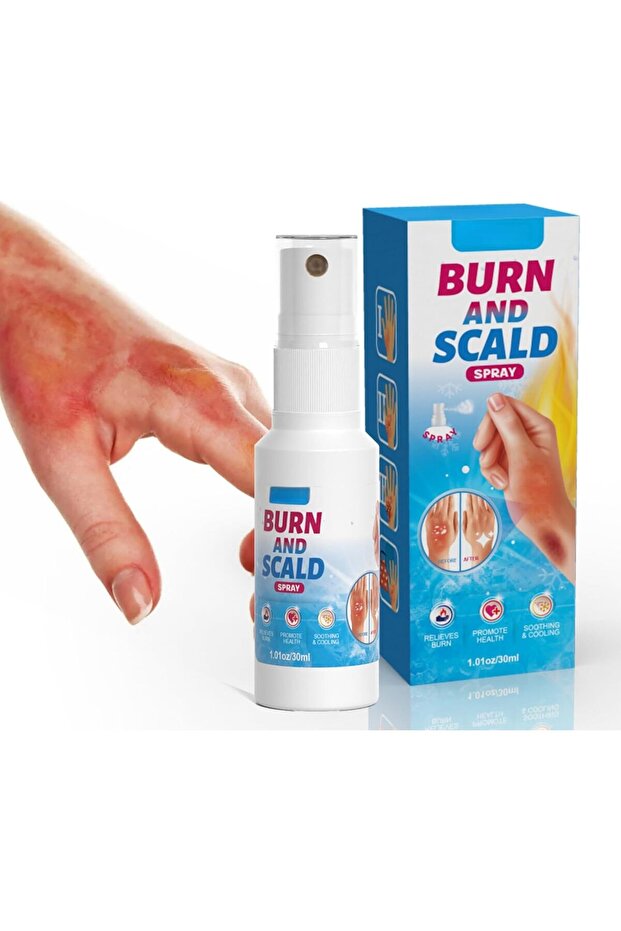 Burn and Scald Spray - 30ml
