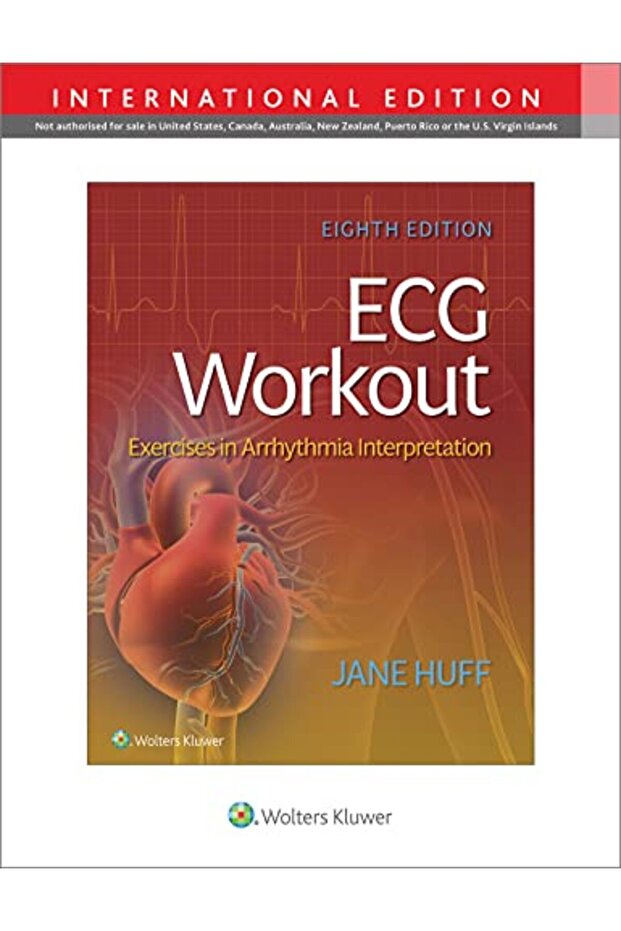 ECG Workout 8e, International Edition