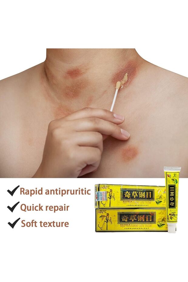 5pcs/Lot Herbal , Psoriasis Creams
