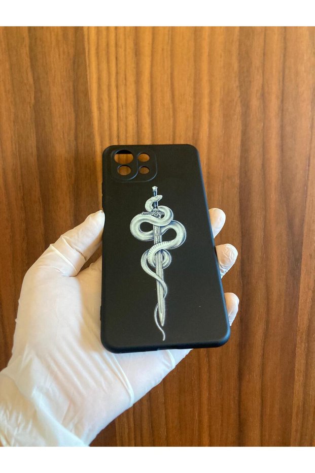Mi 11 Lite Printed Velvet Inside Silicone Phone Case