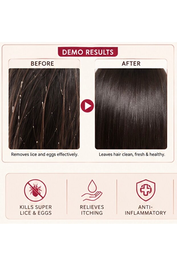 Lice removing - 4