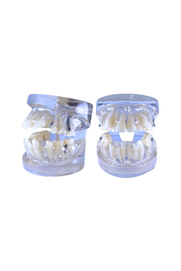 Maxillary Teeth Structure Jaw Model for Dentistry Student and Clinician