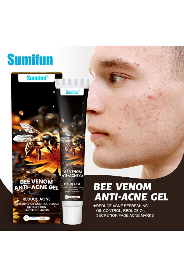 Bee-Venom Anti-Acne Gel, Acne Remover Gel 20g.