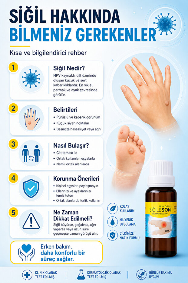 Siğil Solüsyonu - 2