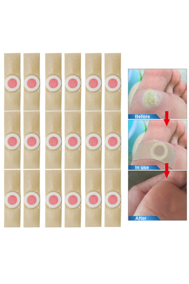 36pcs 36Pcs Foot Toe Corn And Callus Removers Pads Self-Stick Adhesive Foot Cushion Corn Callus Remo