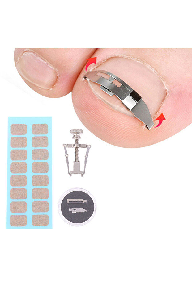 1 Set Ingrown Toenail Corrector Tools Pedicure Recover Embed Toe Nail Treatment Professional Foot...