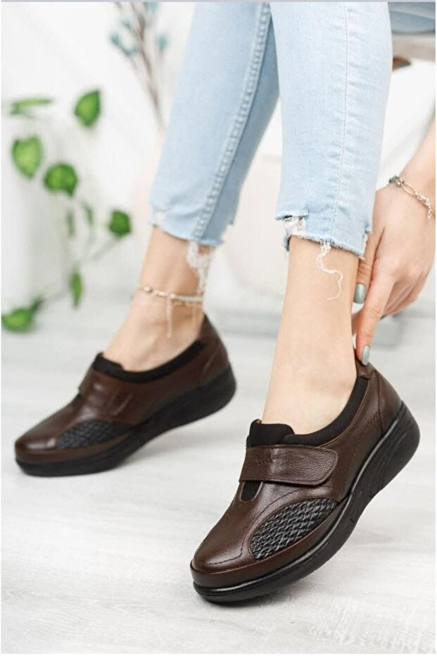 Anatomical Bone Protrusion Heel Spur Candy Shoe
