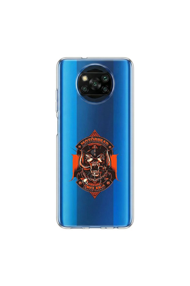حافظة شفافة متوافقة مع Poco X3 Pro مصنوعة من المعدن بتصميم 9