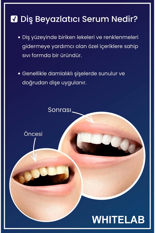 Diş Beyazlatıcı Solüsyon - 3