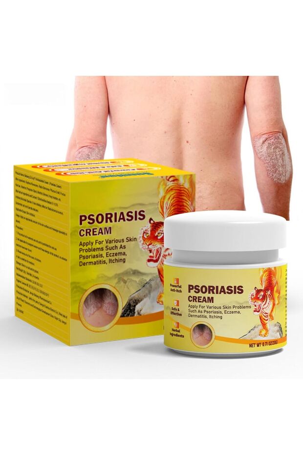 Psoriasis Treatment Cream, 20g - Skin Repair Ointment for Psoriasis, , and Dermatitis - Relieves Itching and Redness - Moisturizing and Soothing Treatment for Hands, Feet, and Body, Hyp
