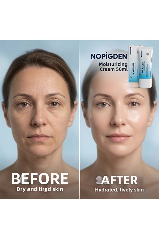 Nopigden Moisturizing Repair Cream 50 ml Daily Skin Care and Moisturizing Cream