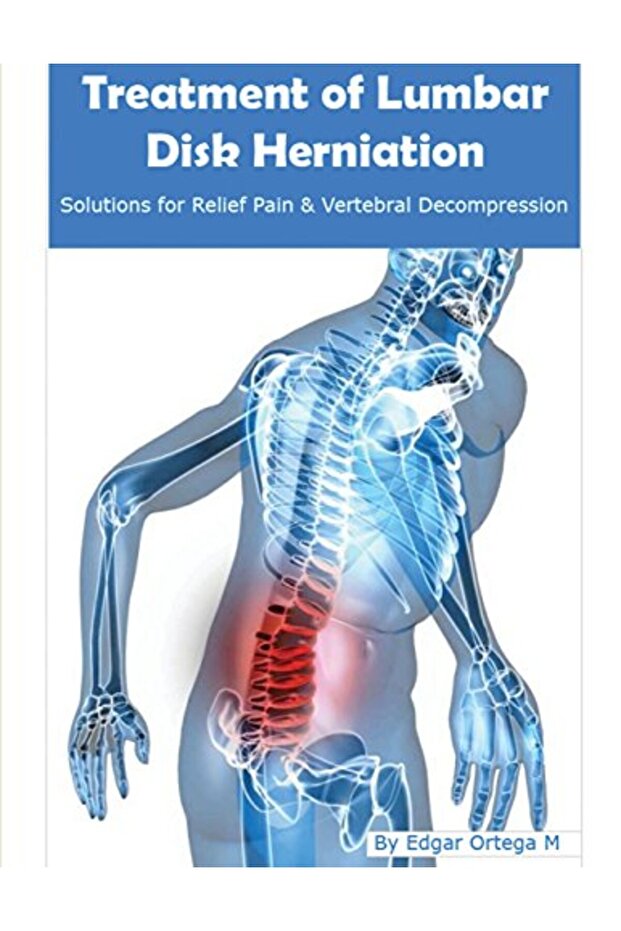 Treatment Of Lumbar Disk Herniation Back Pain Relief And Herniated Discs Solutions