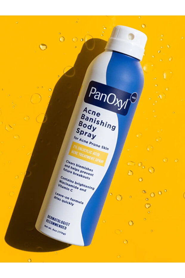 Acne Banishing Body Spray – 2% Salicylic Acid for Back & Chest