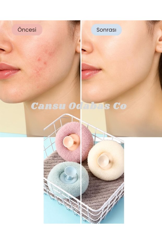 Comedone Anti-Acne Ingrown Hair Remover Facial and Body Scrub