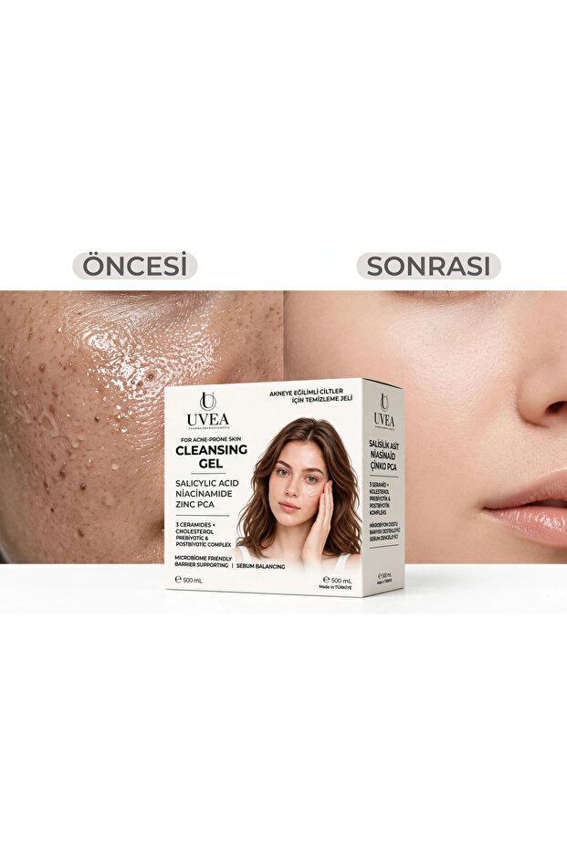Acn Pro Face Wash Gel – Microbiome Supporting, Sebum Balancing Purifying Cleansing Gel for Acne and Prone Skin – 500 ml