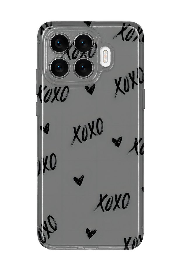 Xiaomi 17t Compatible Xoxo Patterned Transparent Phone Case