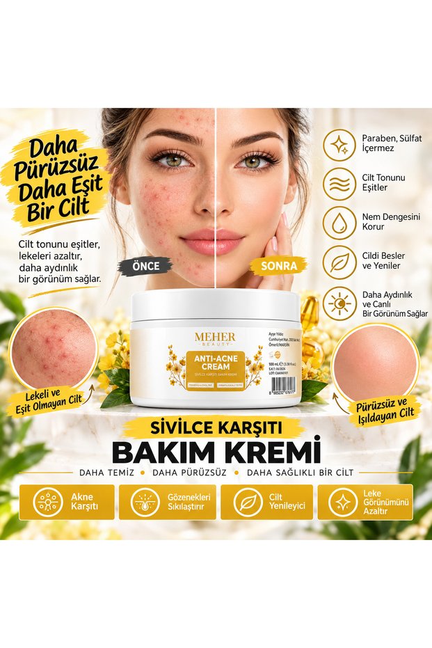 Anti-Pimple Cream Containing Vitamins Blackhead Pimple - Anti-Acne, Blemish Removal Face Cream