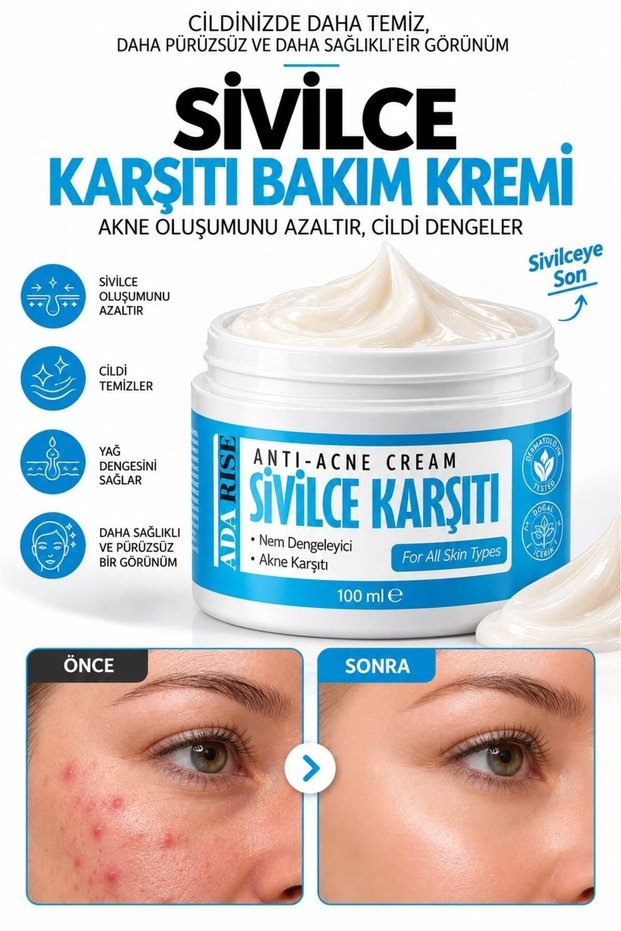 Vitamin-Containing Anti-Pimple Blackhead Pimple - Anti-Acne Cream 100 ml