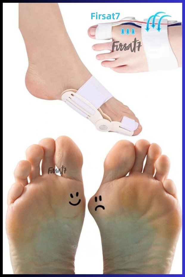 Foot Big Toe Hallux Valgus Night Splint Corrector Foot Big Toe Bone Protrusion Regulator Apparatus Splint