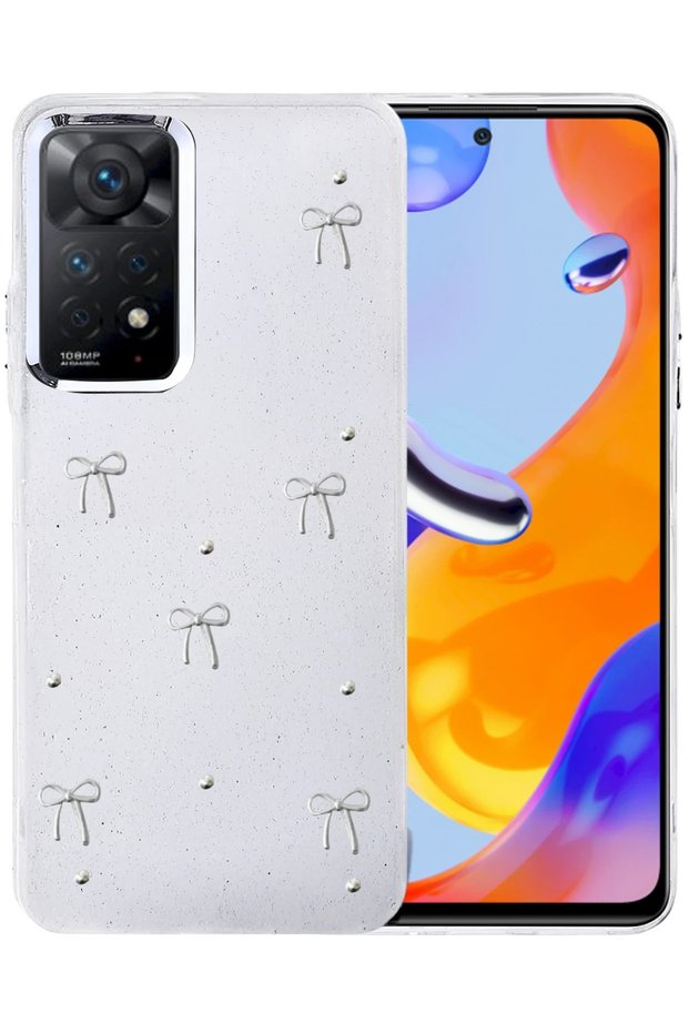 Ilkestor Newface Redmi Note 11 Pro Bow Patterned Cover - (143617) Pattern 5