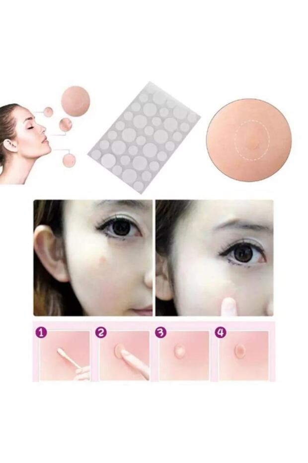 Sivilce Bandı - Acne Pimple Master Patch 36 Adet - 3