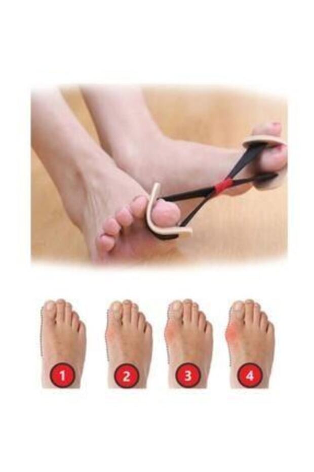 ExerciseHalluxVagus - Finger Bone Corrector Elastic Bunion - 3