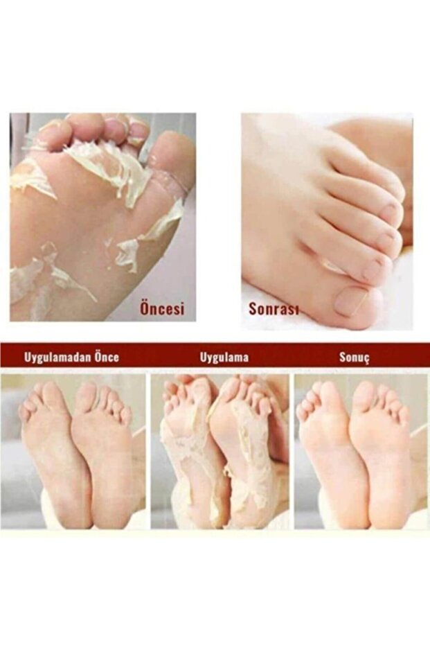 Proffessional Foot Peeling Pack 35 ml - 4