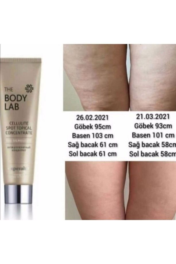 The Lab Cellulite Spot Topical Concentrate/selülit Ve Çatlak Kremi/siberian Wellness - 5