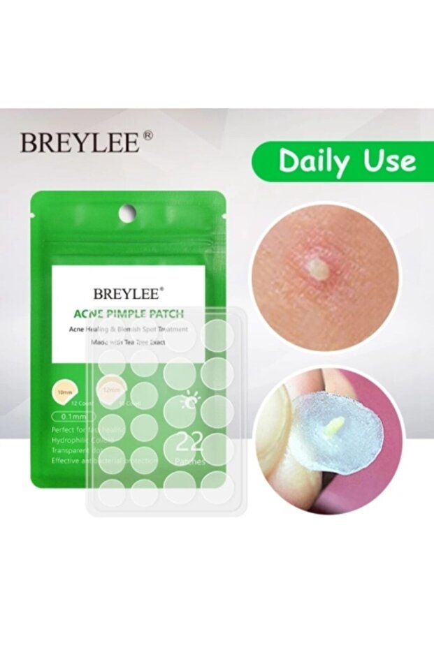 Lovyco Sivilce Bandı - Acne Pimple Patch 22 Adet - 2