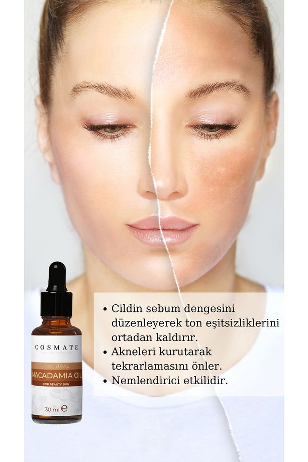Doğal Soğuk Sıkım Cadı Fındığı Yağı Macadamia Oil 30 ml - 2