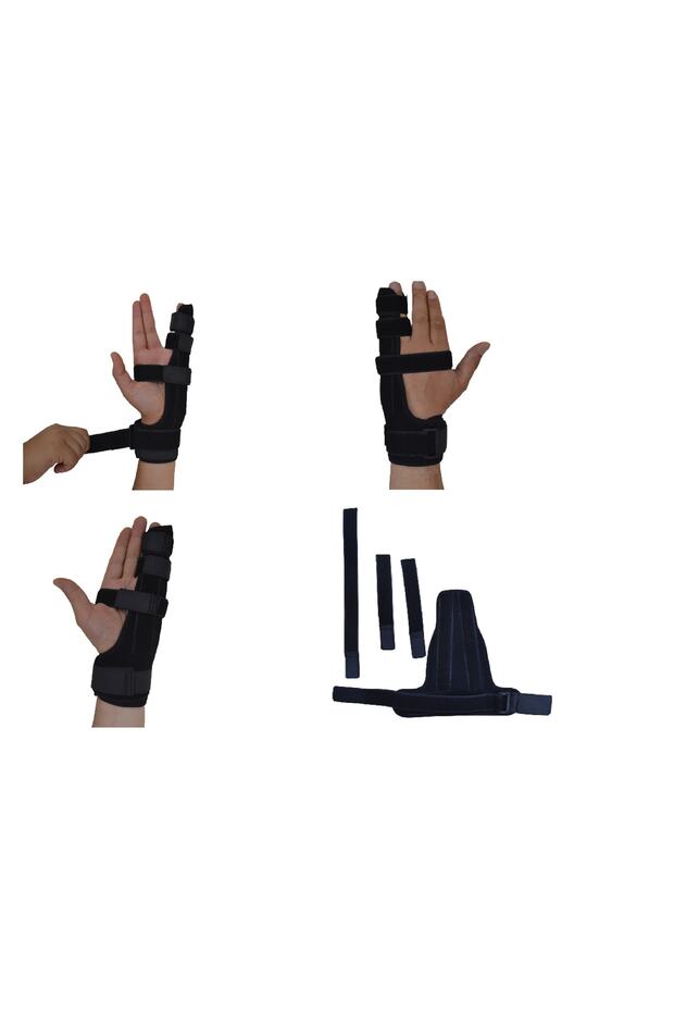 Boxer Fracture Splint Right-Left Handed Double Metal - 1
