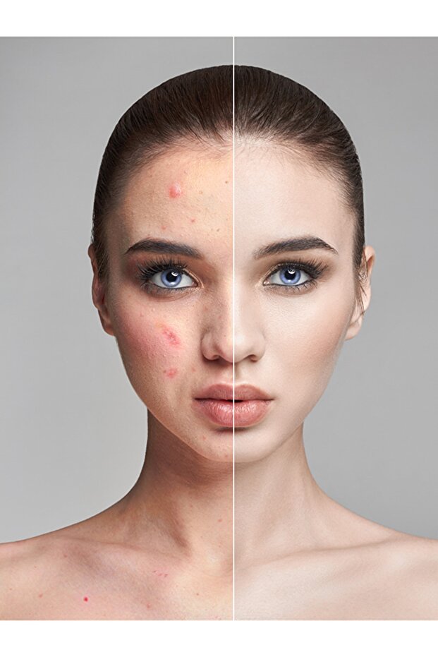 Green Mask Stick Premium - 5