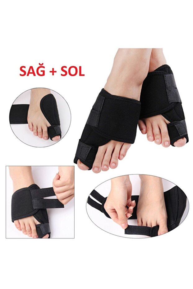 Halluks Valgus Gece Ateli Ayak Başparmak Kemiği Çıkıntısı Bunyonu - 3
