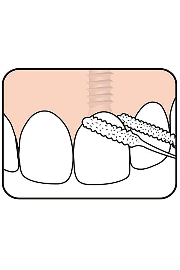 Bridge Implant Floss 5 Li Diş Ipi - 3