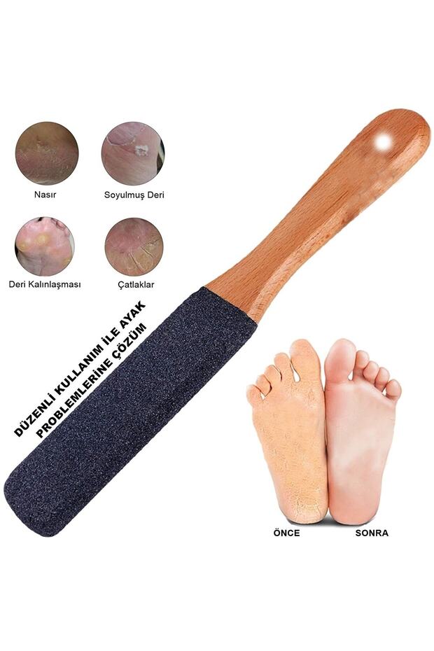 Ayak Topuk Törpüsü - 1