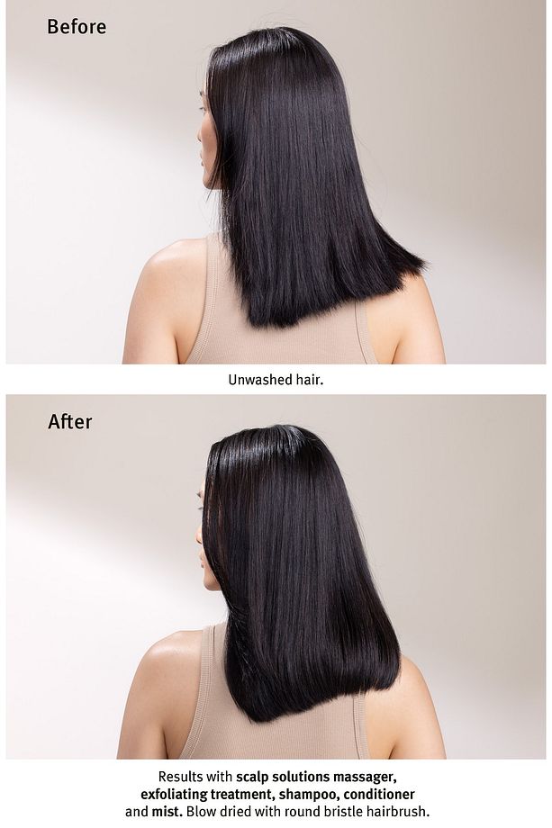 Scalp Solutions Saç Derisi Için Jel Peeling 25ml 018084040515 - 7