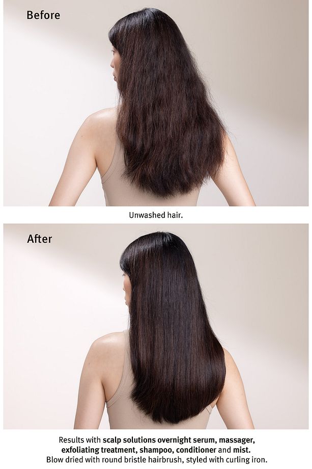 Scalp Solutions Saç Derisi Için Şampuan 200ml 018084040546 - 5