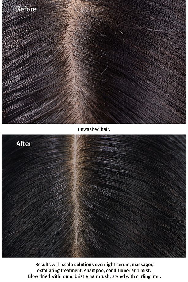 Scalp Solutions Saç Derisi Için Şampuan 200ml 018084040546 - 6