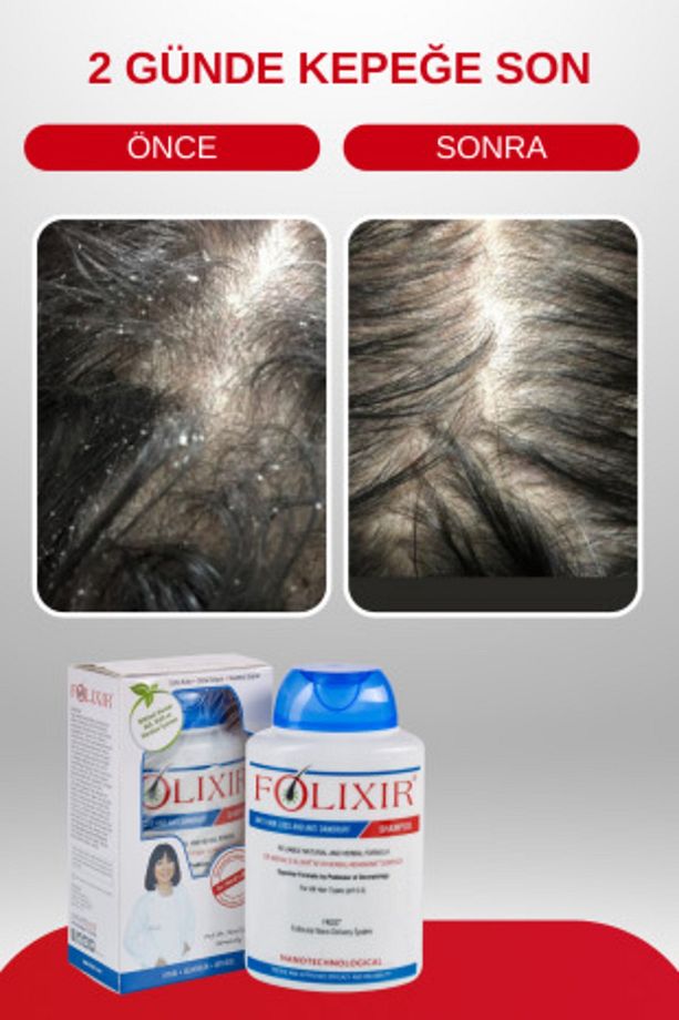 Saç Dökülmesi Ve Kepeğe Karşı Şampuan 300 Ml - 4