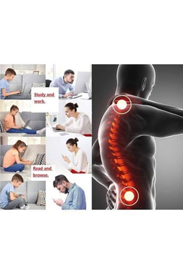 Patterned Anti-Hump Corset - 2