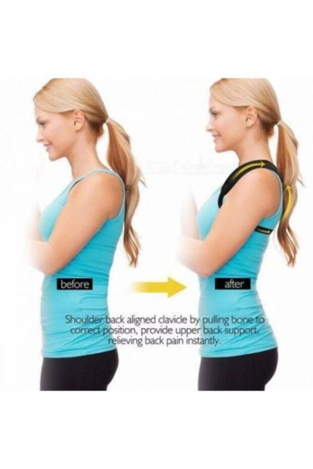 Patterned Anti-Hump Corset - 8