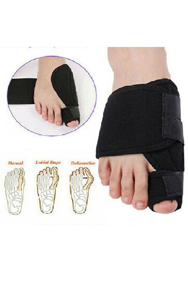 Unisex Black Toe Big Toe Night Splint