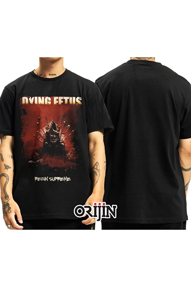 Dying Fetus Reign Supreme Printed Unisex Black Tshirt