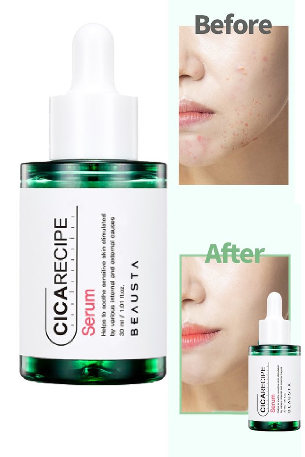 Anti-Soothing Serum Containing Cica Centella – Special Care for Sensitive Skin