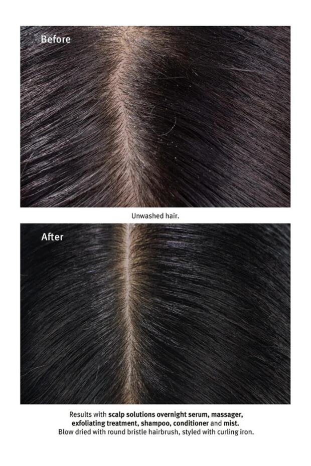 Saçı ve Saç Derisini Kurutmayan Vegan Scalp Solutions Şampuan 200ml. - 3