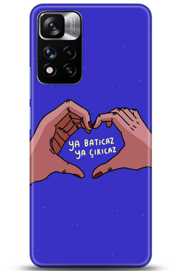 Xiaomi Redmi Note 11 Pro Plus 5g Case Hd Printed Case - Followed Institution 0562