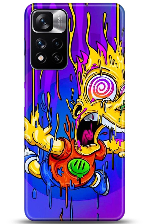 Xiaomi Redmi Note 11 Pro Plus 5g Case Hd Printed Case - Followed Institution 0158