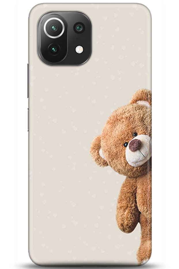 Xiaomi Mi 11 Lite Case HD Printed Case - Followed Institution 0005