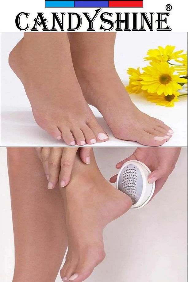 Pratik Ergonomik Ayak Topuk Törpüsü Rendesi Ölü Deri Ve Nasır Temizleyici Rötuş Zımparalı - 4
